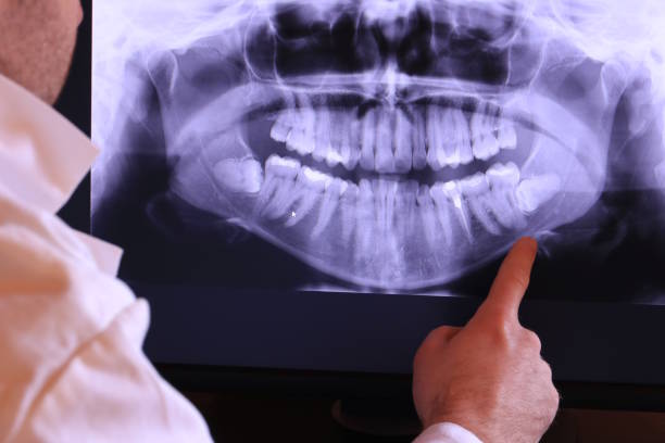 Best Emergency Gum Treatment in Farmland, IN